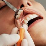 imagen del artículo: ¿Por qué el tratamiento dental está excuido de las prestaciones de la seguridad social?
